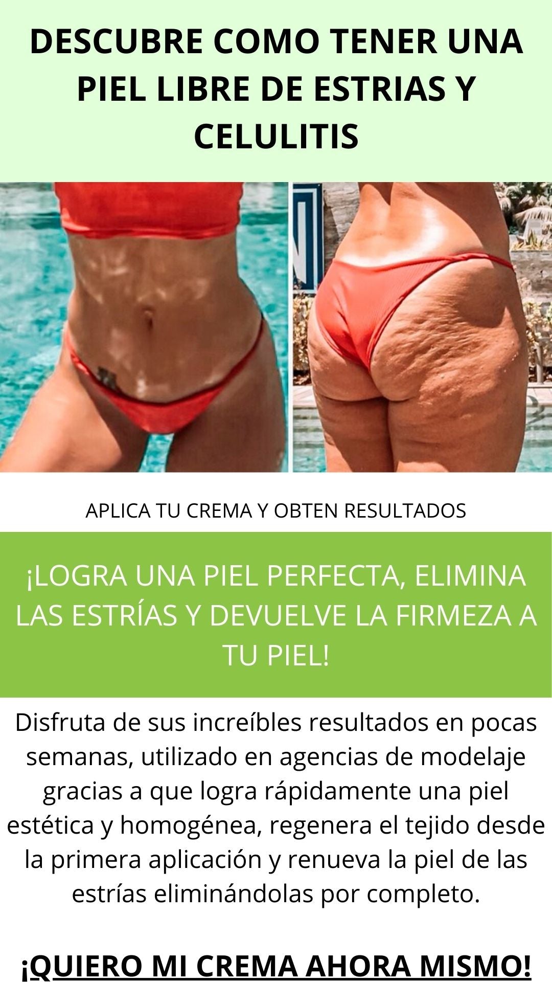 CREMA HOMEOPATICA PARA ESTRIAS Y CELULITIS CICATRIM