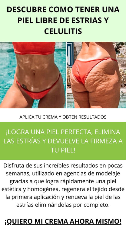 CREMA HOMEOPATICA PARA ESTRIAS Y CELULITIS CICATRIM